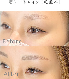眉アートメイク(毛並み) Before/After